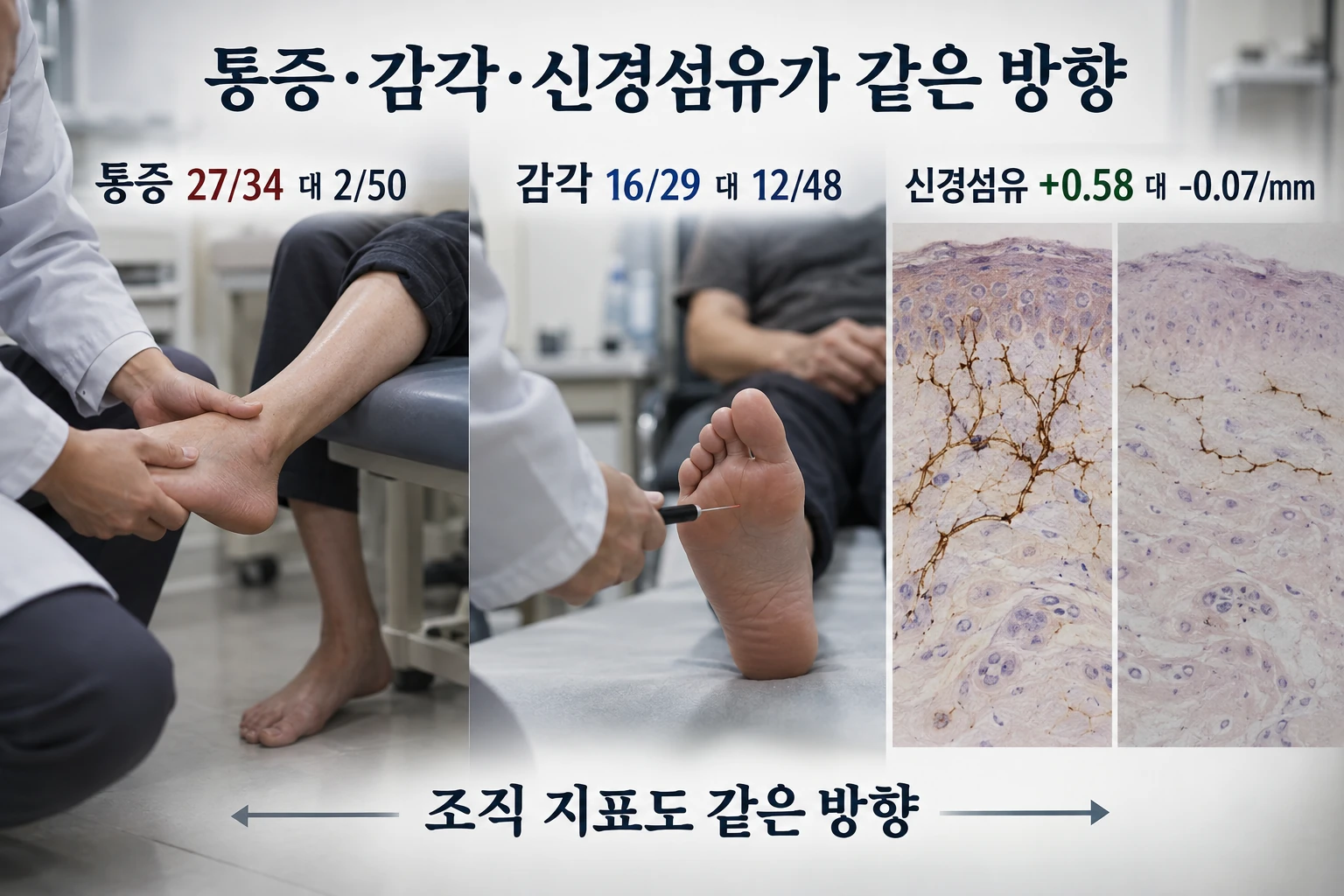 통증성 당뇨병 신경병증, 척수자극술은 통증뿐 아니라 감각도 좋아졌을까 연구 결과와 적용 한계를 보여주는 3번째 인포그래픽
