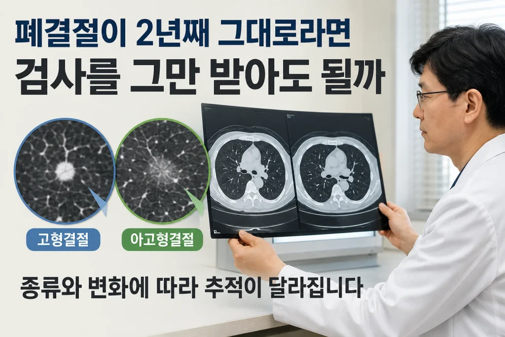 폐결절이 2년째 그대로라면 검사를 그만 받아도 될까 핵심 내용을 보여주는 대표 이미지